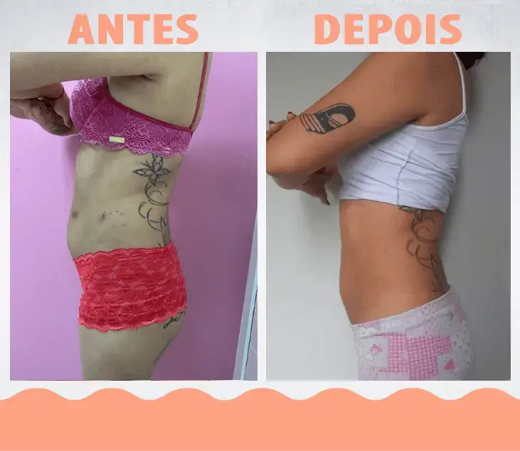 AntesDepois-LipoEnzimática02